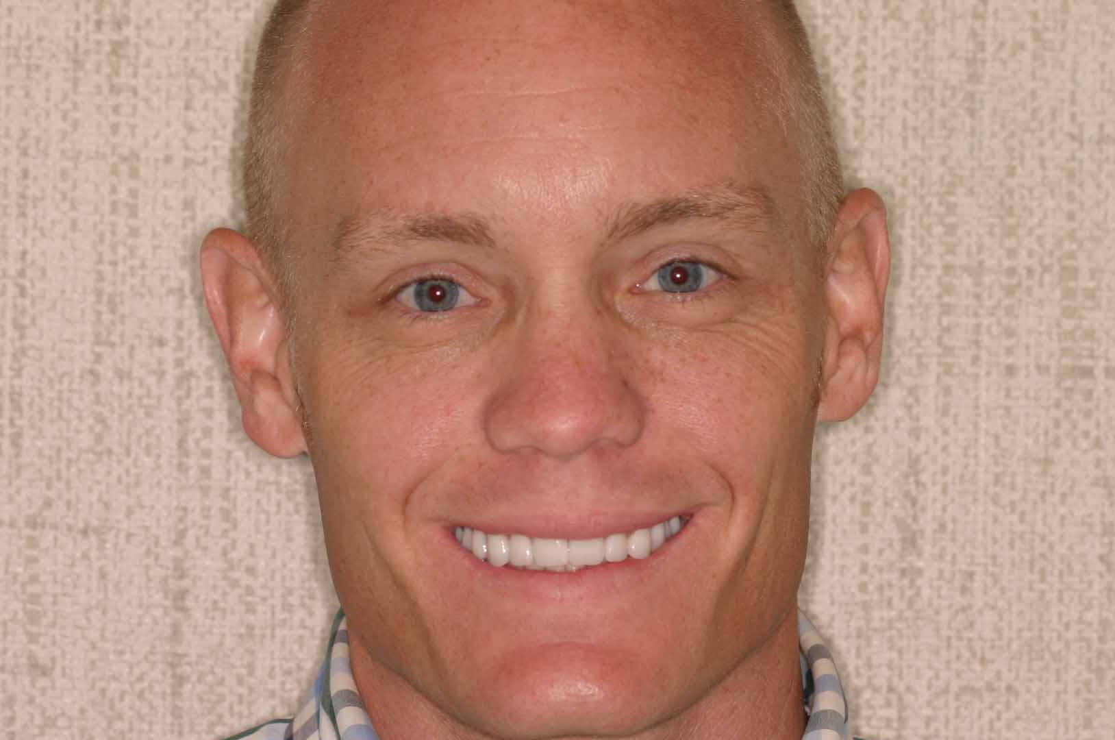 Cosmetic Dentist Fort Myers Cape Coral Naples FL